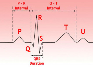 Электрокардиограмма сердца расшифровка пример
