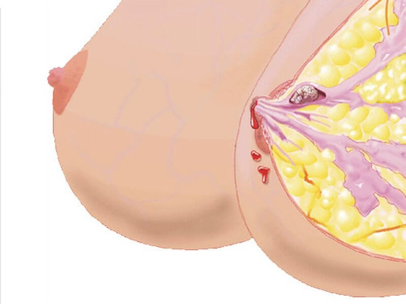 Строение женской груди