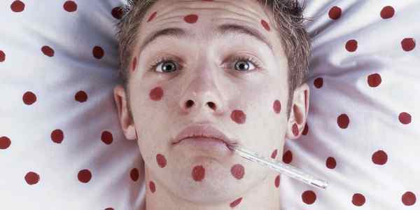 Аллергия может проявляться в виде красных пятен