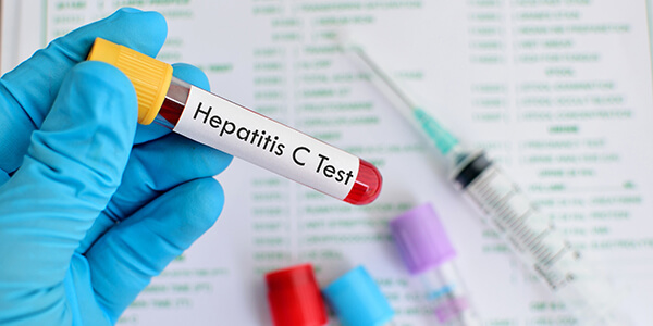 Анализ на гепатит С