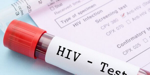 Тест на HIV