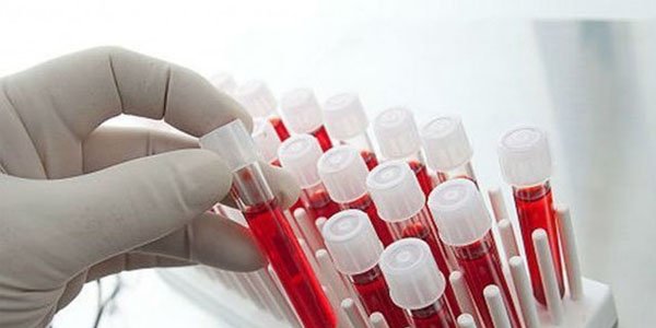 Анализ крови на ВИЧ-инфекцию